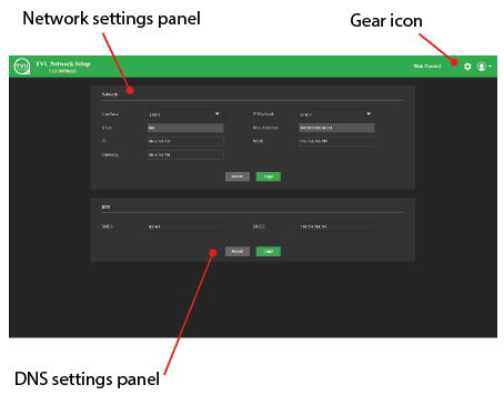 TVU Network setup interface