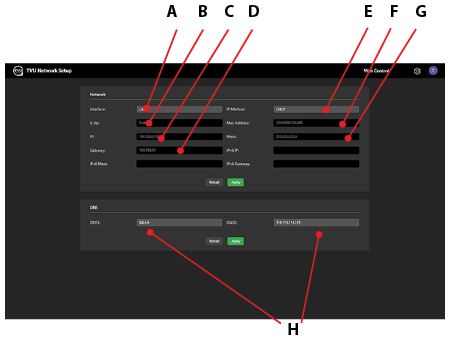 TVU Receiver Network interface 2
